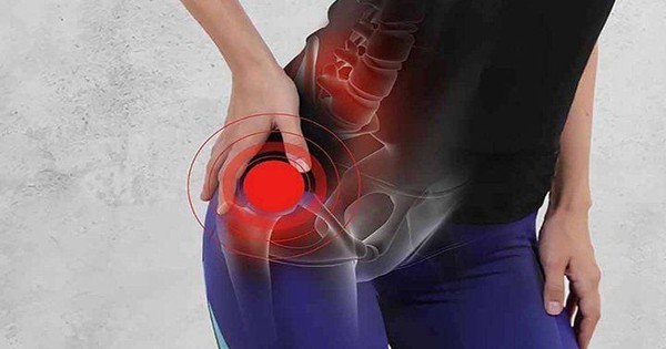Viêm khớp háng, nhận biết sớm giúp ngăn ngừa hệ lụy