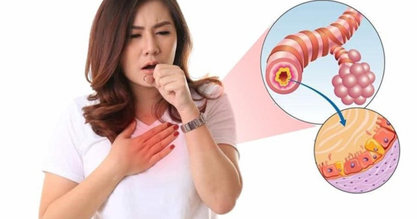 Dùng kháng sinh điều trị viêm phế quản cấp tính: Hiểu đúng để điều trị hiệu quả