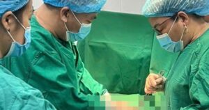 Cứu sống sản phụ người Lào chửa ngoài tử cung bị vỡ