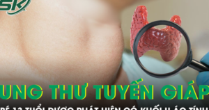 Bé 13 tuổi ung thư tuyến giáp, bác sĩ cảnh báo dấu hiệu dễ bỏ qua