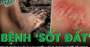 Bệnh ‘sốt đất’ bùng phát tại Thái Lan khiến hàng chục người tử vong