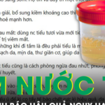 Cảnh báo trào lưu dùng nước tiểu để tắm, rửa mặt gây nguy hại sức khỏe