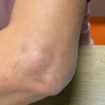 Cảnh báo mạo danh bác sĩ Bạch Mai tiêm thuốc khiến người bệnh gặp biến chứng