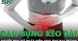 Đau bụng kéo dài tưởng rối loạn tiêu hoá, người phụ nữ phát hiện ung thư đại tràng