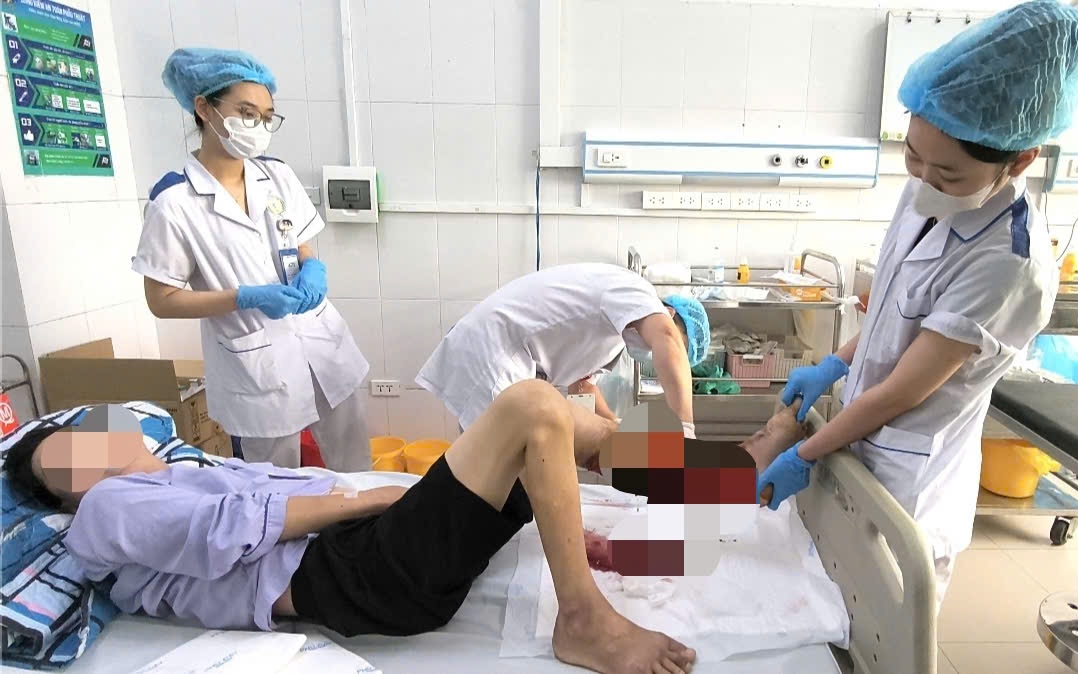 Người đàn ông cấp cứu sau bữa ngan luộc- Ảnh 1.