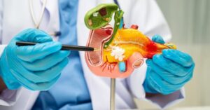 ‘Vũ khí bí mật’ giúp bệnh nhân chiến thắng ung thư tụy sau 6 năm