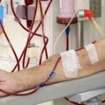 Nhiều bệnh nhân hồi sức nguy cơ suy thận, lọc máu liên tục cần làm sớm, không chờ ‘giai đoạn muộn’