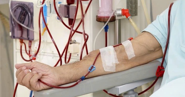 Nhiều bệnh nhân hồi sức nguy cơ suy thận, lọc máu liên tục cần làm sớm, không chờ ‘giai đoạn muộn’