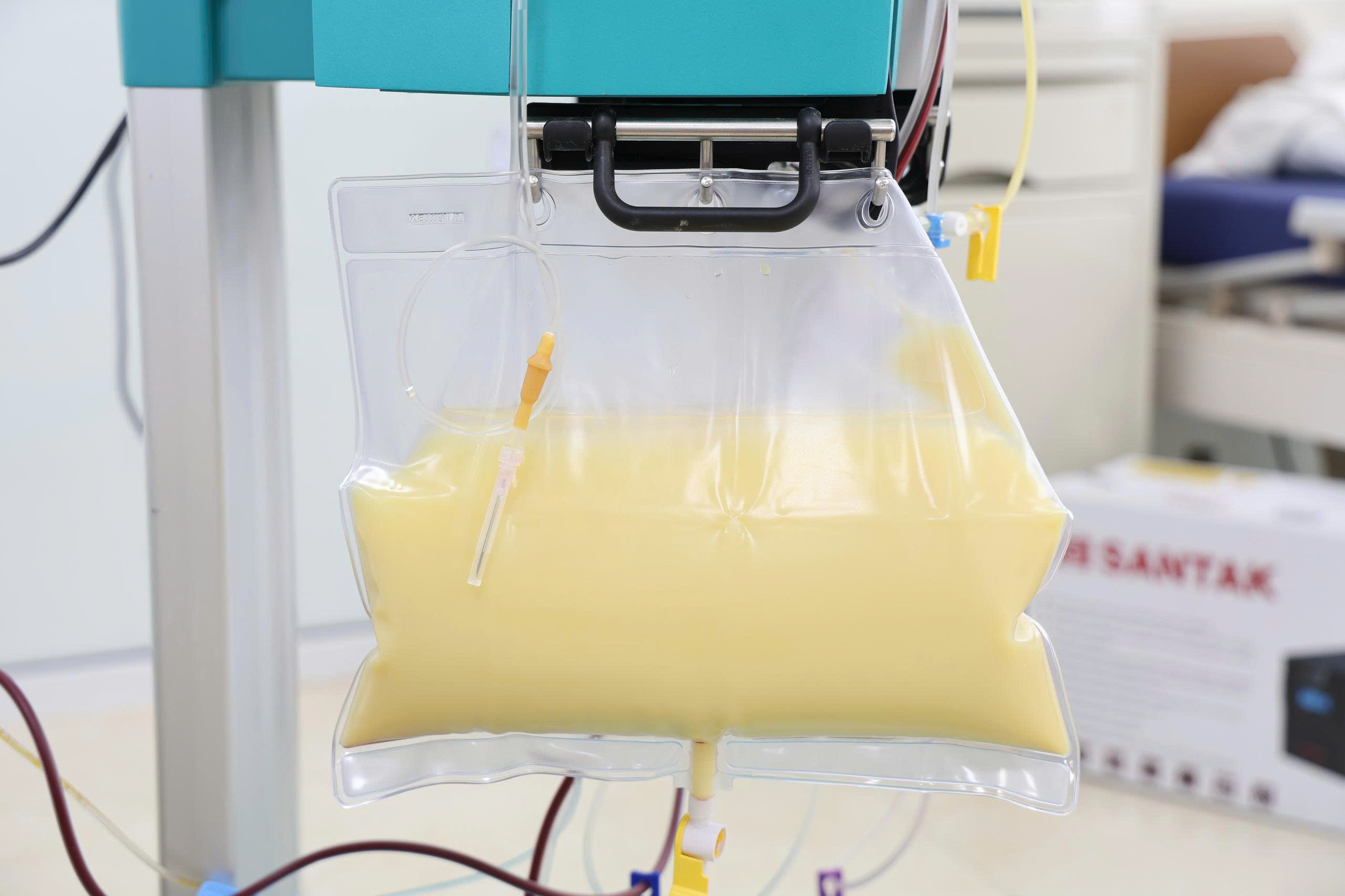 Lọc máu cứu sống thai phụ 34 tuần có chỉ số mỡ máu tăng gấp gần 20 lần- Ảnh 2.