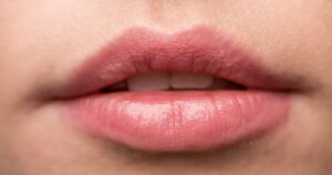 3 bí quyết trị thâm và khôi phục sắc môi hồng tự nhiên