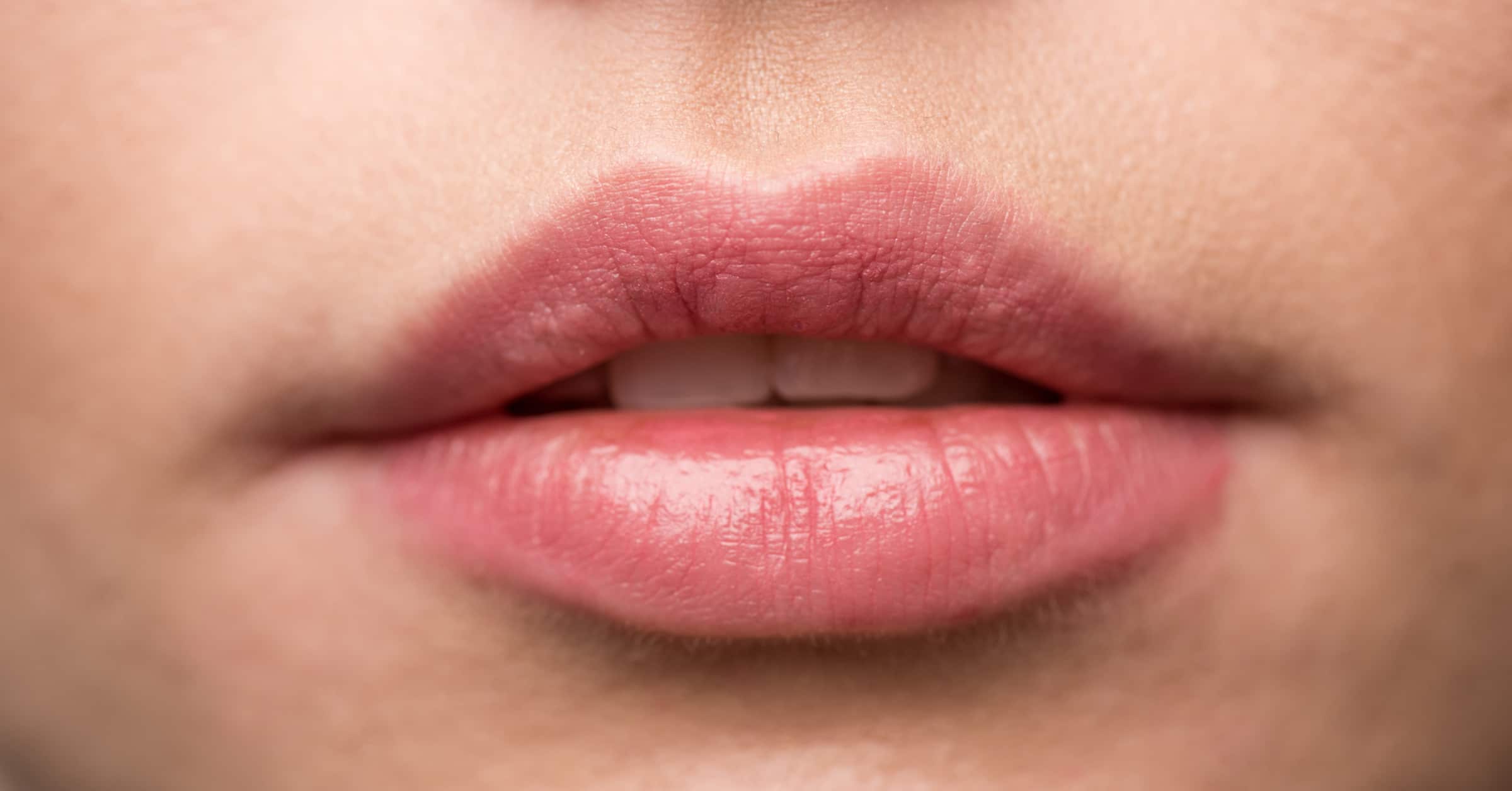 3 bí quyết trị thâm và khôi phục sắc môi hồng tự nhiên- Ảnh 1.