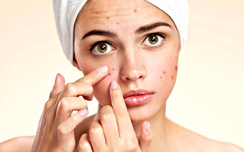 Nguyên nhân mọc mụn trứng cá ở lưng, yếu tố thường gặp nhưng dễ bị bỏ qua- Ảnh 2.