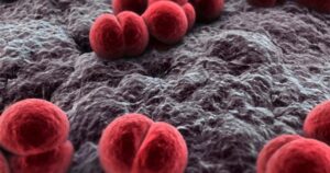 Ghi nhận 18 ca mắc não mô cầu tại phía Nam: Cách phòng bệnh hiệu quả