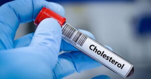 5 biện pháp không dùng thuốc kiểm soát cholesterol cao hiệu quả