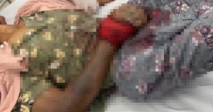 Liên tiếp ca nhập viện nguy kịch do rắn cắn, cách xử trí đúng tránh biến chứng