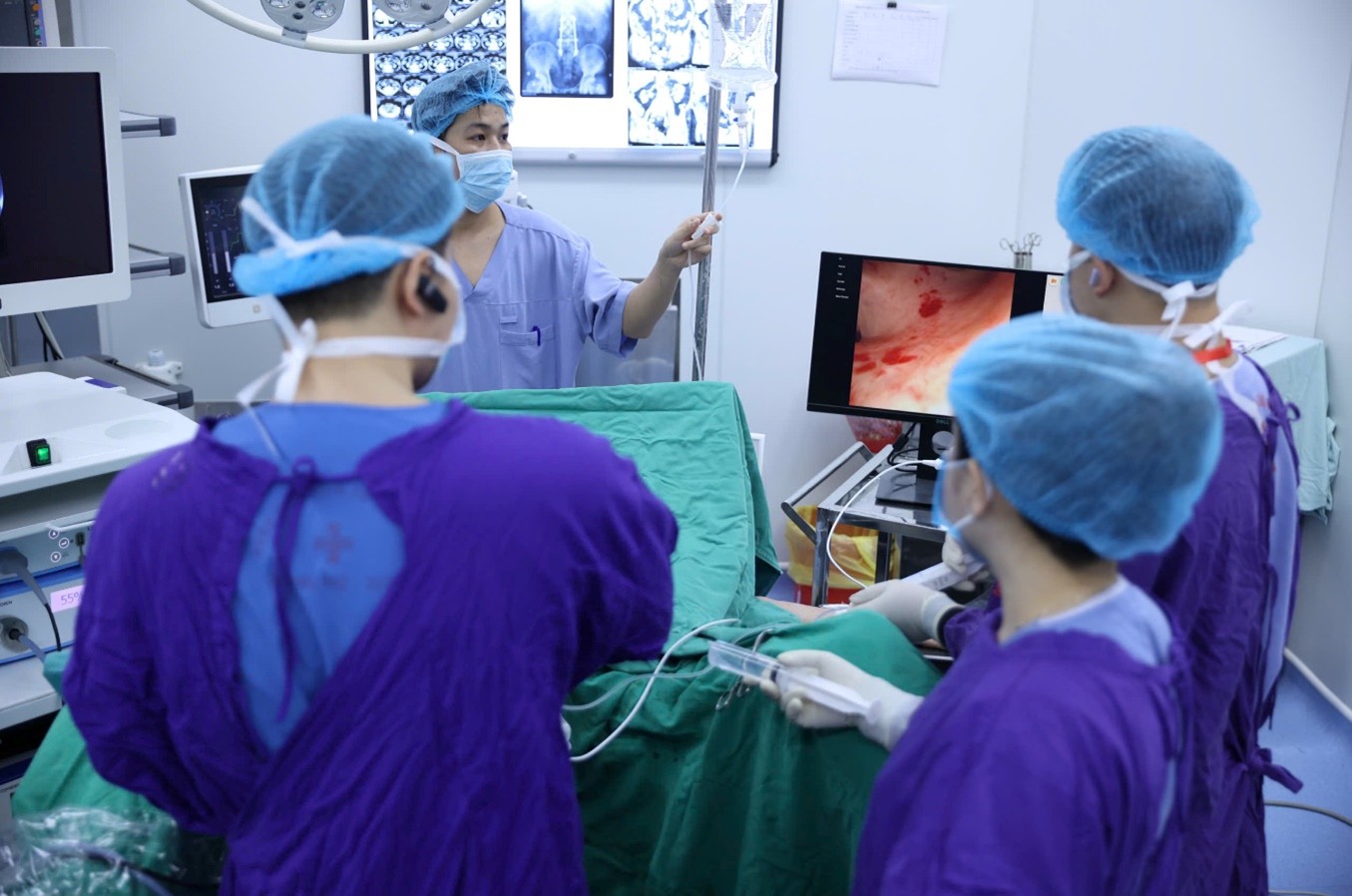 Cách tán sỏi thận không sẹo mổ- Ảnh 2.