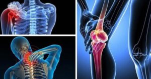 Không vận động mạnh tại sao vẫn bị thoái hoá?