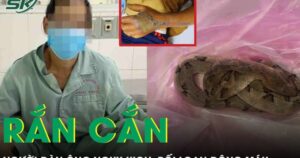Bị rắn chàm quạp cắn, người đàn ông sưng nề, rối loạn đông máu