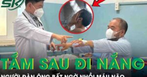 Tắm ngay sau đi nắng về, người đàn ông bất ngờ đột quỵ nhồi máu não