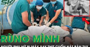 Người phụ nữ phải cắt cụt 4 ngón tay vì bị máy xay thịt cuốn nát