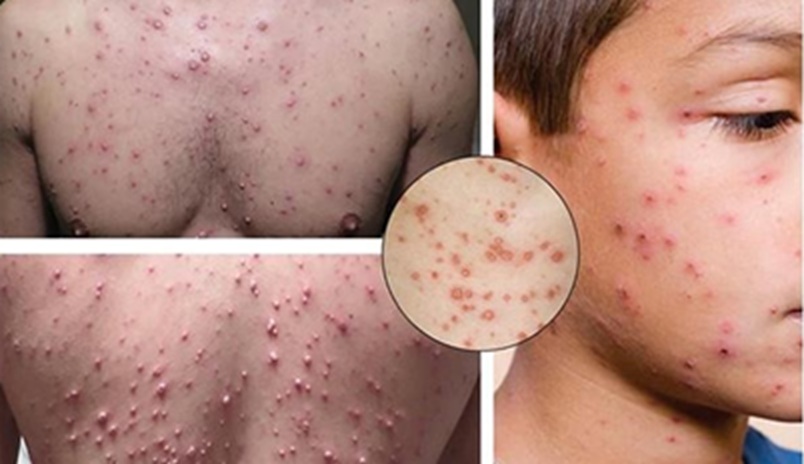 Dập ổ dịch thủy đậu ở xã vùng biên Quảng Trị- Ảnh 2.