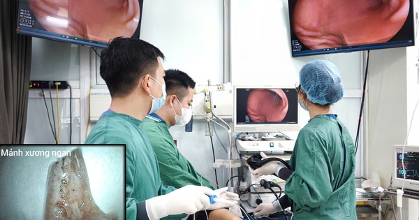 Người đàn ông cấp cứu sau bữa ngan luộc