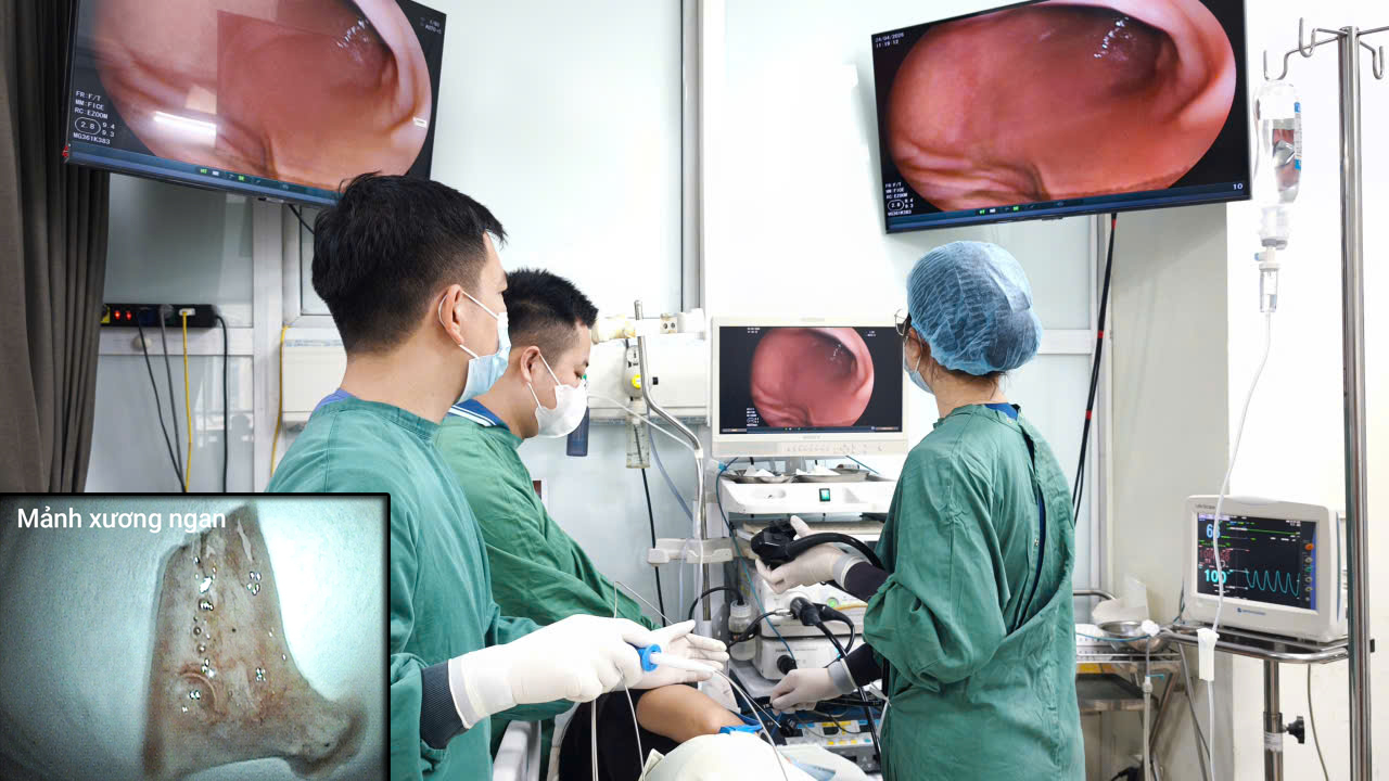 Người đàn ông cấp cứu sau bữa ngan luộc- Ảnh 3.