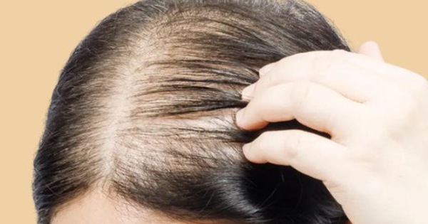 5 thói quen gây hại khiến tóc ngày càng mỏng đi