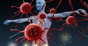 Những bộ phận nào trên cơ thể thường gây ung thư và cách phòng tránh hiệu quả