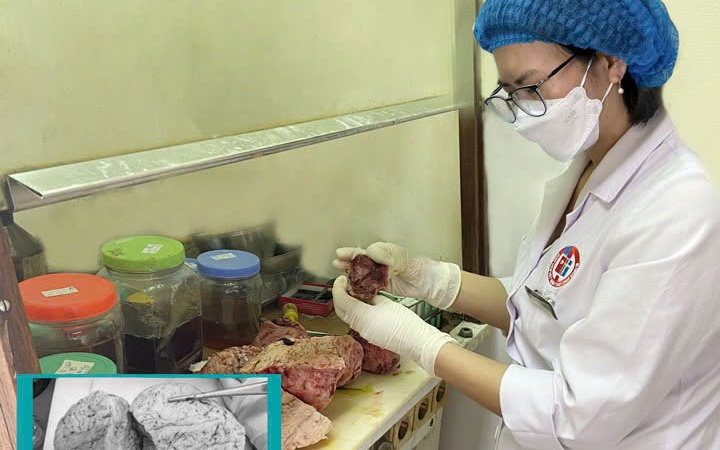 Giành lại thiên chức làm mẹ sau dính buồng tử cung nặng- Ảnh 2.