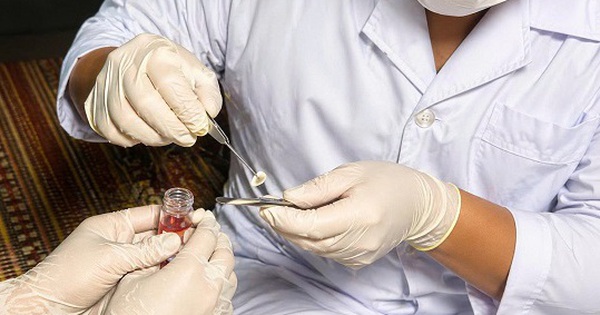 Ca hiến giác mạc đầu tiên tại Bệnh viện Đa khoa Bắc Ninh số 1
