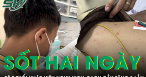 Bé trai 7 tuổi nhập viện nguy kịch sau hai ngày sốt, bạch cầu tăng 8 lần
