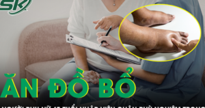 Ăn liên tục đồ bổ thận, người phụ nữ 45 tuổi nhập viện, chân phù nghiêm trọng