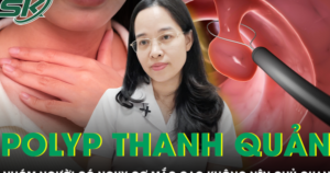 Những người có nguy cơ mắc polyp thanh quản cao tuyệt đối không thể chủ quan