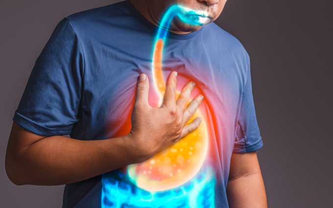 5 nguy cơ khi dùng nhiều thuốc giảm tiết acid ở người trào ngược dạ dày - thực quản- Ảnh 4.