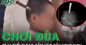 Hai anh em chơi đùa tại nhà, bé 11 tuổi bị dao cắm vào đầu nguy kịch