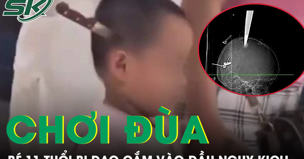 Hai anh em chơi đùa tại nhà, bé 11 tuổi bị dao cắm vào đầu nguy kịch
