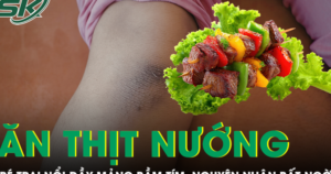 Bé trai nổi đầy mảng bầm tím sau bữa ăn thịt nướng, bác sĩ phát hiện nguyên nhân bất ngờ