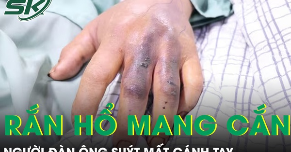 Đi làm ruộng bị rắn hổ mang cắn, người đàn ông suýt mất cánh tay