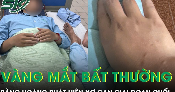 Da và mắt vàng bất thường, chàng trai 21 tuổi bàng hoàng phát hiện xơ gan giai đoạn cuối