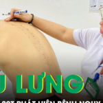 Tưởng đau lưng do tập gym, nam thanh niên 20 tuổi phát hiện mắc bệnh nguy cơ gây tàn phế