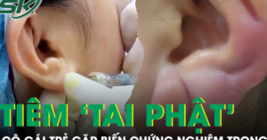 Tiêm filler làm ‘tai Phật’ ở spa, cô gái trẻ gặp biến chứng nghiêm trọng
