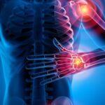 Hyalu Leva giúp người dùng hiểu đúng về chăm sóc xương khớp chủ động