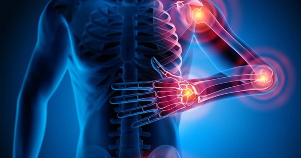 Hyalu Leva giúp người dùng hiểu đúng về chăm sóc xương khớp chủ động