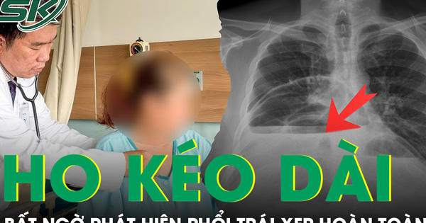 Ho kéo dài nhiều tuần, người phụ nữ bất ngờ phát hiện phổi trái xẹp hoàn toàn vì bệnh hiếm