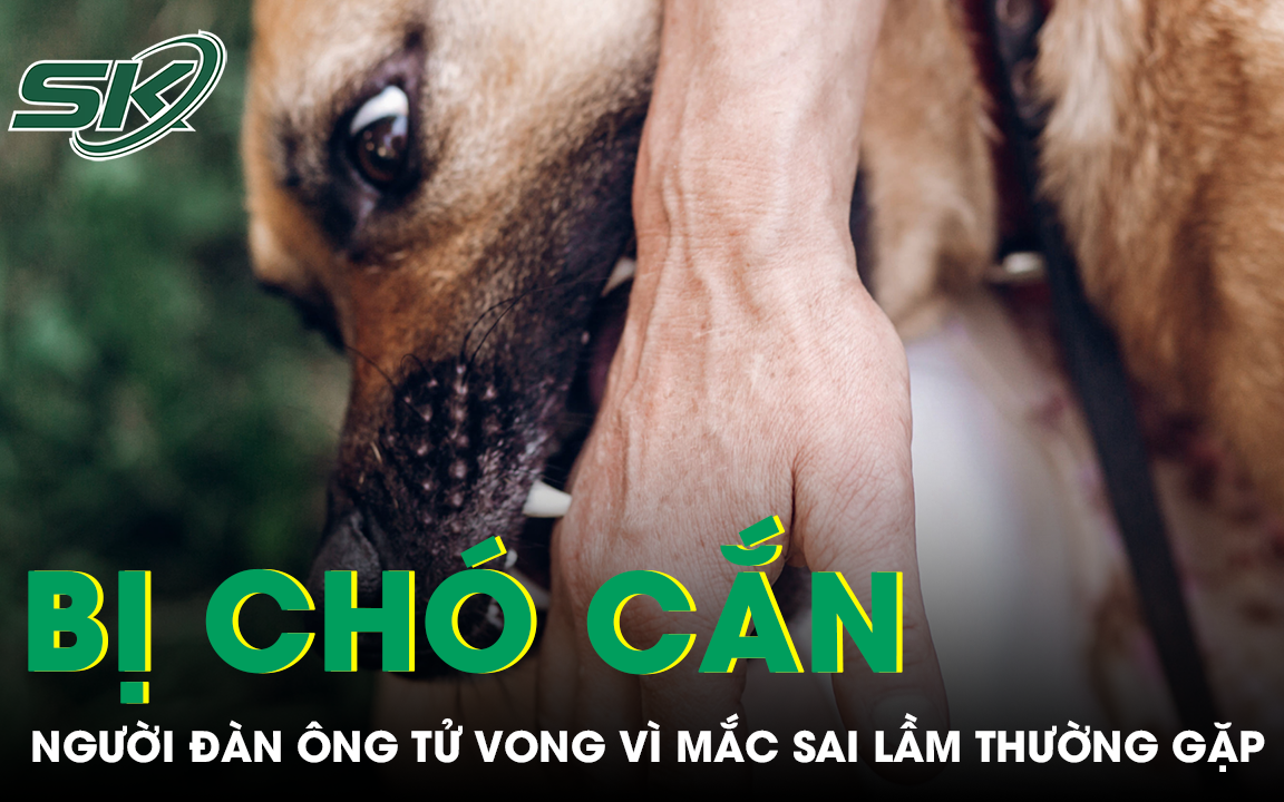 Đừng chủ quan khi chó nhà cắn- Ảnh 3.