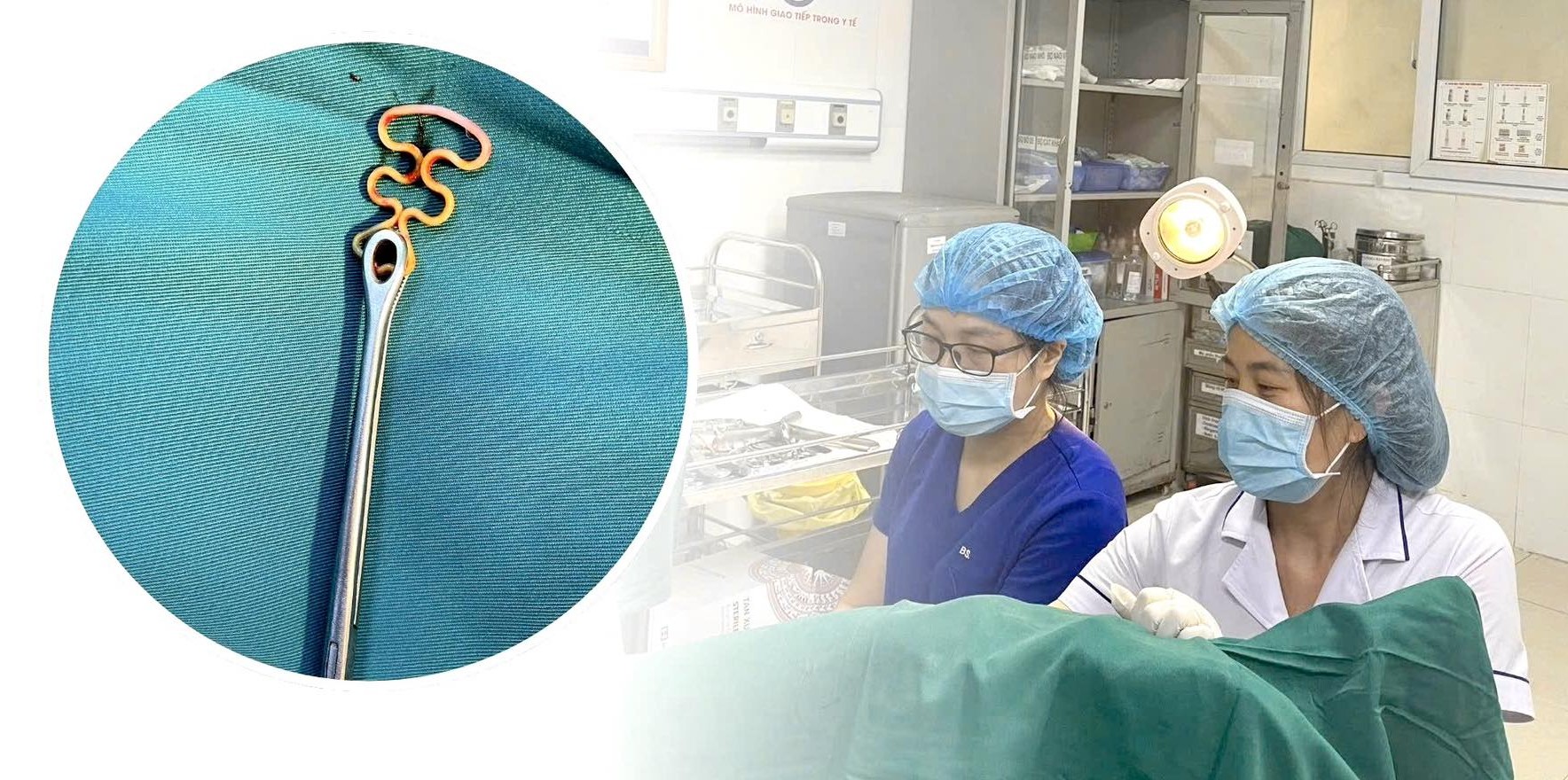 Bỏ quên vòng tránh thai suốt 30 năm, người phụ nữ 63 tuổi gặp biến chứng phụ khoa
- Ảnh 1. Bỏ quên vòng tránh thai suốt 30 năm, người phụ nữ 63 tuổi gặp biến chứng phụ khoa
- Ảnh 1.