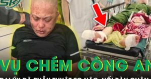 Đại úy công an bị chém tại trụ sở đã được nối lại bàn chân và phẫu thuật sọ não