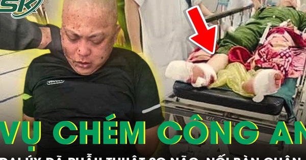 Đại úy công an bị chém tại trụ sở đã được nối lại bàn chân và phẫu thuật sọ não