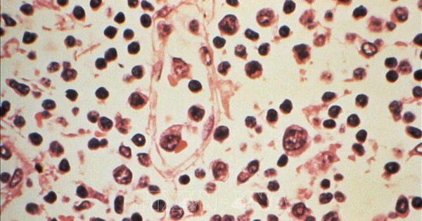 Đài Loan (Trung Quốc) ghi nhận 1 ca tử vong do nhiễm virus Hanta